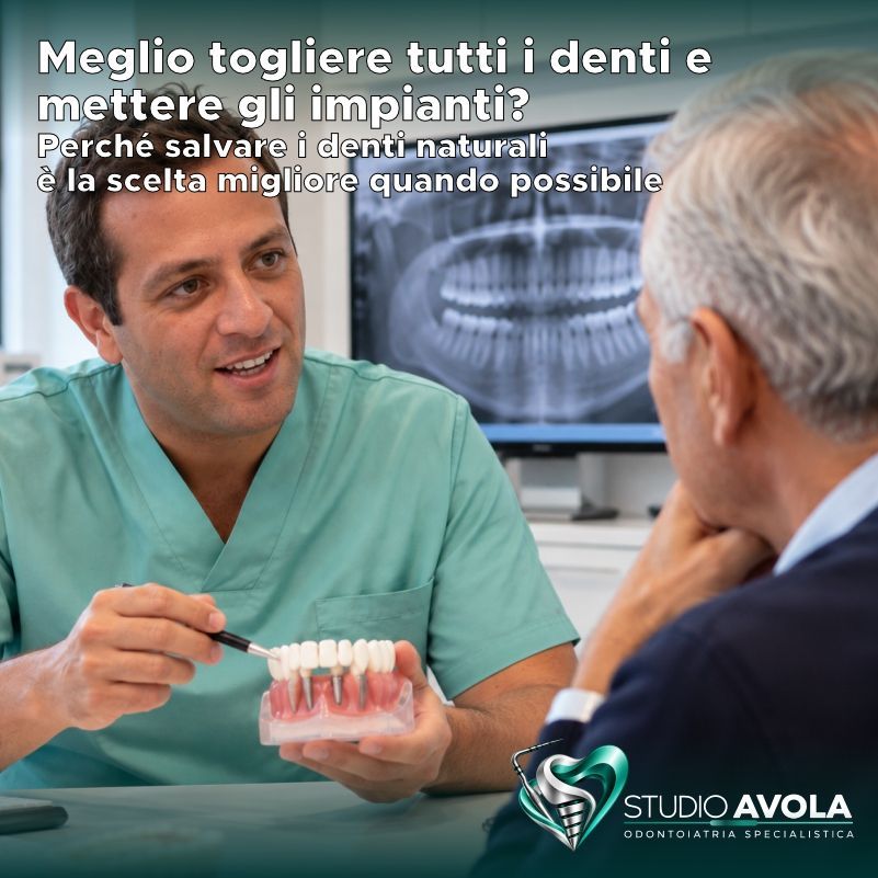 Meglio togliere tutti i denti e mettere gli impianti? Perch&eacute; salvare i denti naturali &egrave; la scelta migliore quando possibile