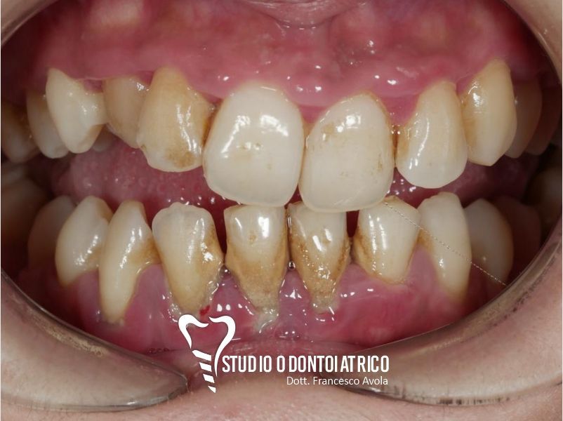 Prima del trattamento odontoiatrico