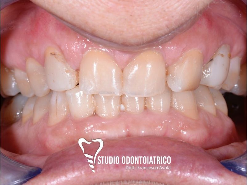 Prima del trattamento odontoiatrico