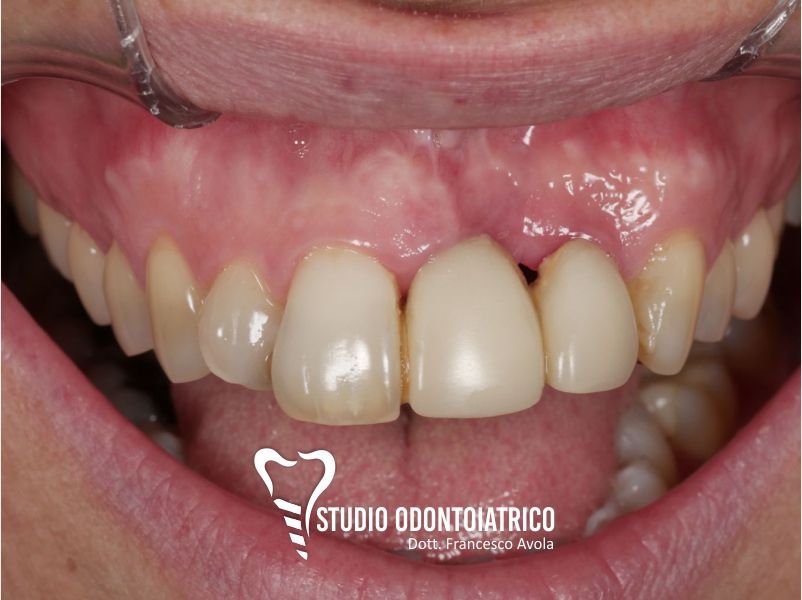 Prima del trattamento odontoiatrico