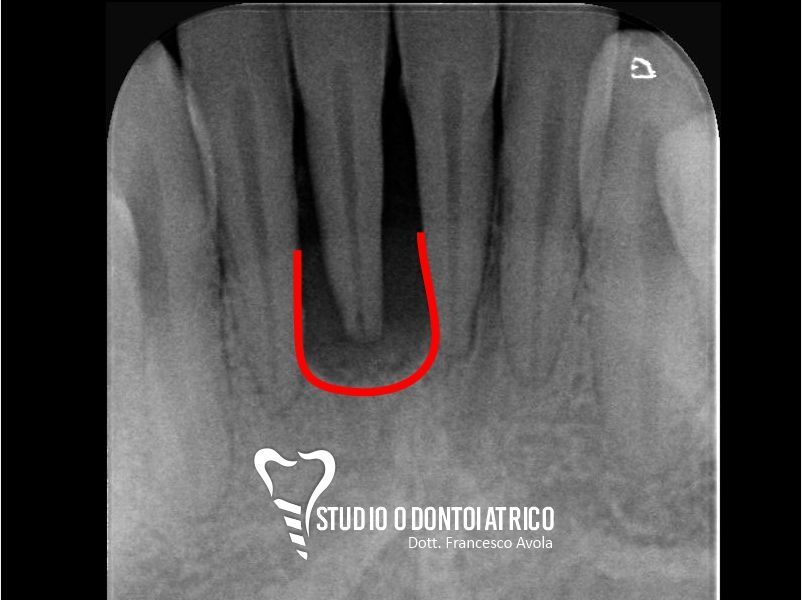Prima del trattamento odontoiatrico