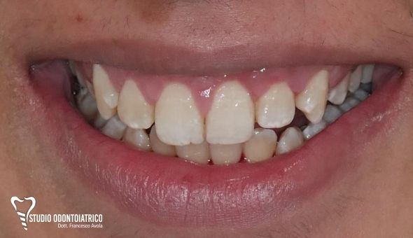 Estetica Dentale