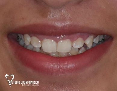 Estetica Dentale