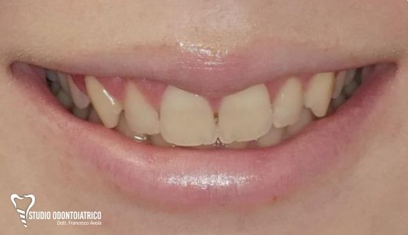 Estetica Dentale