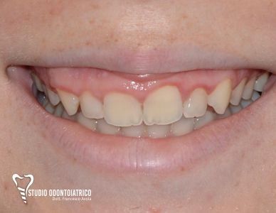 Estetica Dentale