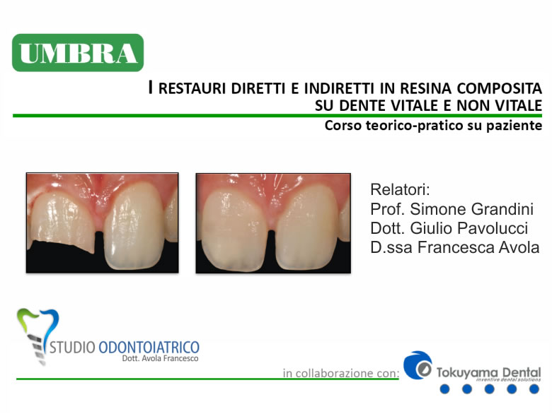 II° incontro corso teorico pratico: I restauri diretti e indiretti in resina composita su dente vitale e non vitale