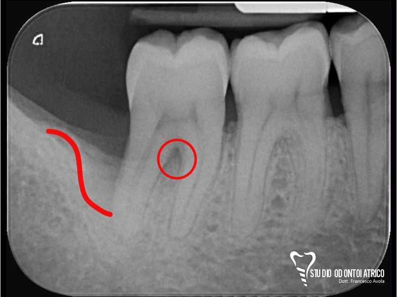 Prima del trattamento odontoiatrico
