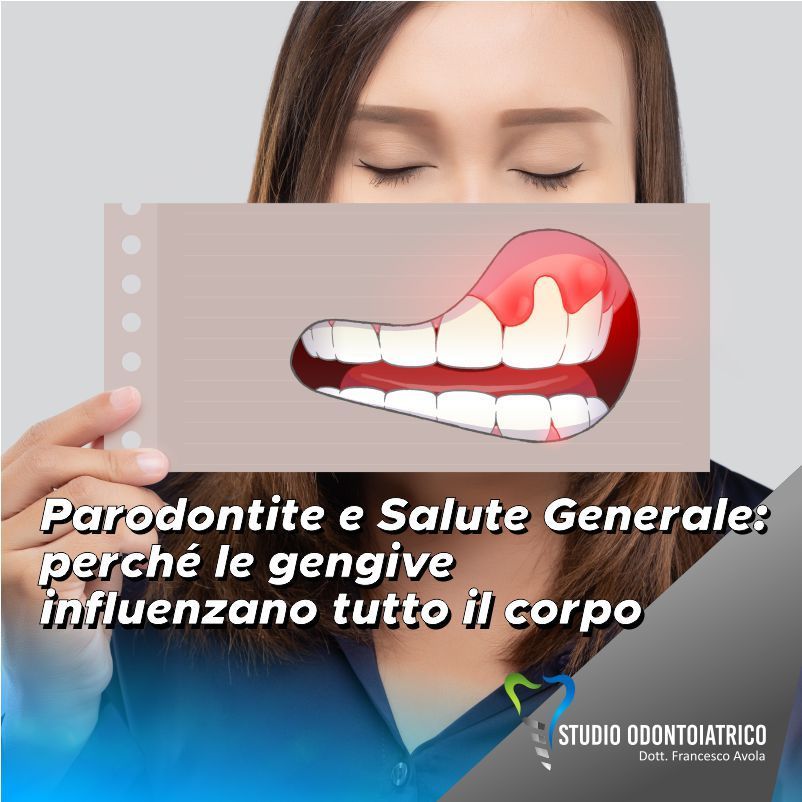 Parodontite e Salute Generale: perchè le gengive influenzano tutto il corpo