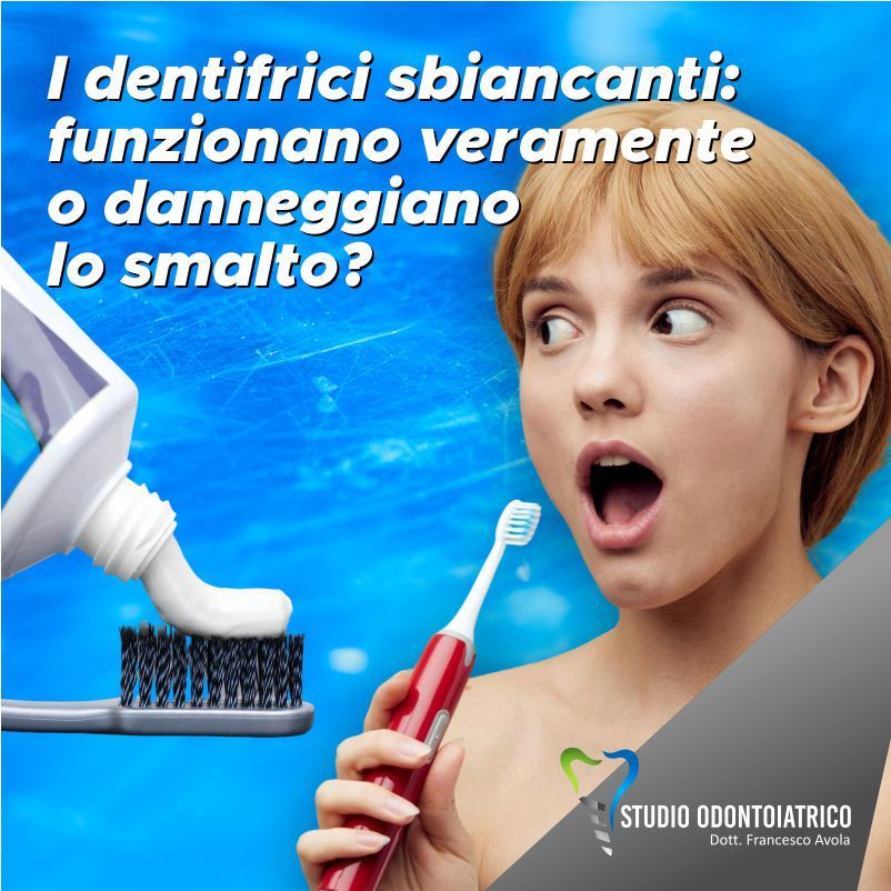 I dentifrici sbiancanti: funzionano veramente o danneggiano lo smalto?