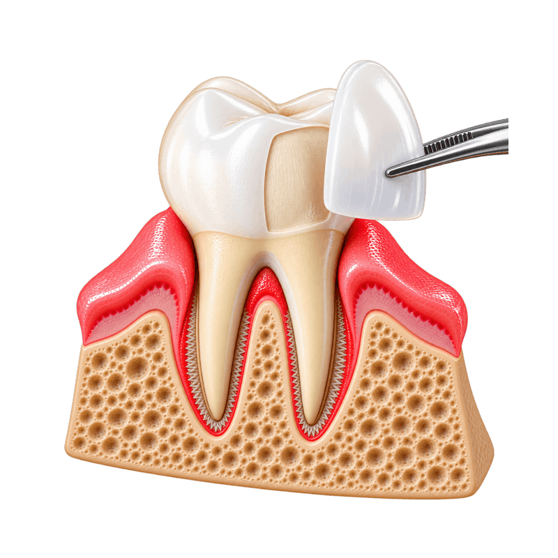 Estetica Dentale