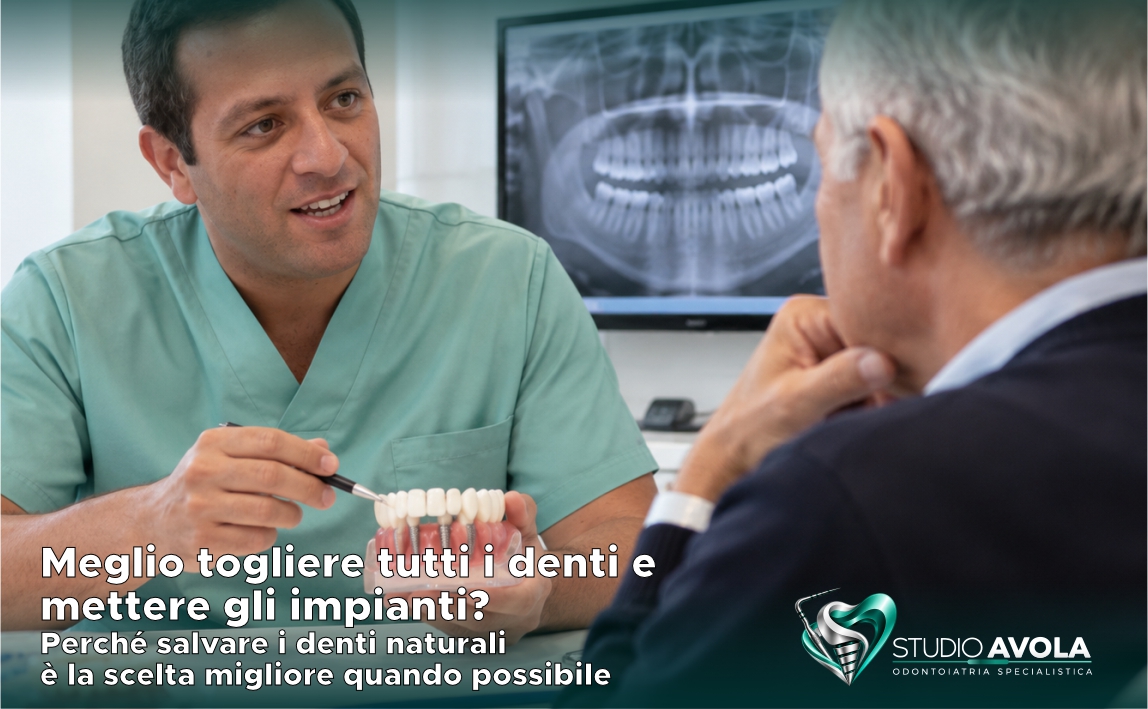 Meglio togliere tutti i denti e mettere gli impianti? Perch&eacute; salvare i denti naturali &egrave; la scelta migliore quando possibile