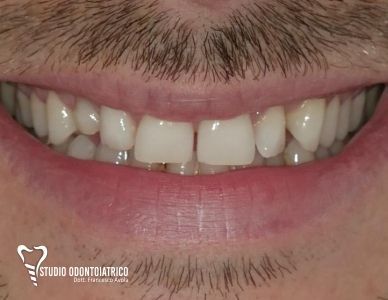 Estetica Dentale