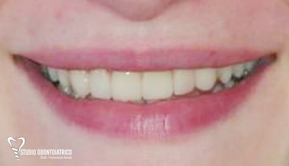 Estetica Dentale