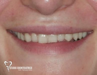 Estetica Dentale