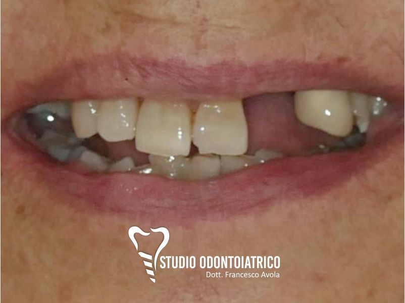 Prima del trattamento odontoiatrico